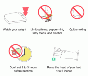 reflux-treatment