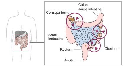 ibs-1